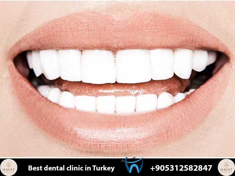 all inclusive dental packages
