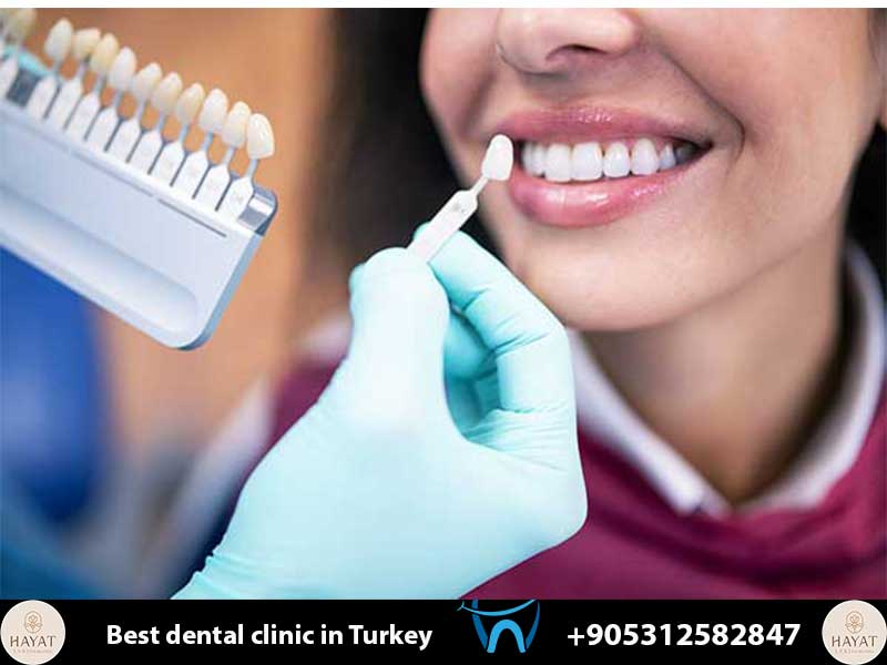 7 Factors Influencing Dental Costs Turkey: Your 2026 Price & Savings Guide dental costs turkey