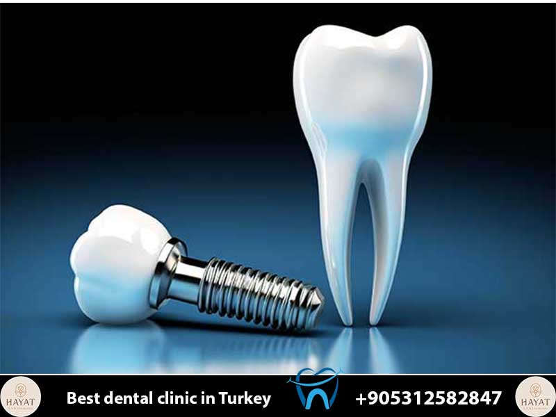 dental implants for smokers risks tips