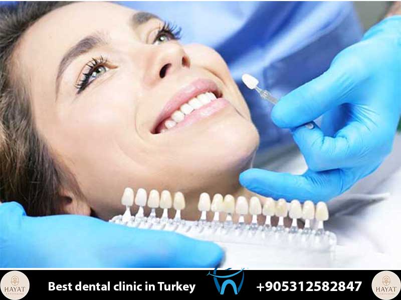 Hollywood Smile Full Cost: The Ultimate 2026 Price Guide to a Perfect Transformation hollywood smile full cost