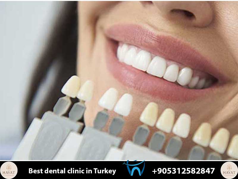 How to Avoid Dental Tourism Scams in Turkey: 10 Red Flags to Watch for in 2026 how to avoid dental tourism scams in turkey