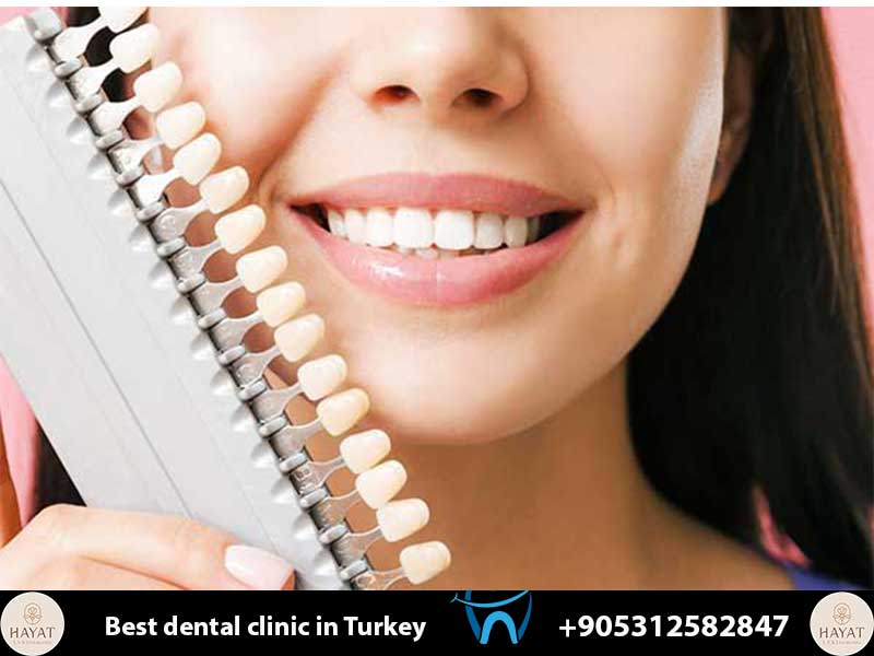 how to fix bad veneers revision dentistry