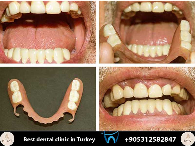 patient before after gallery