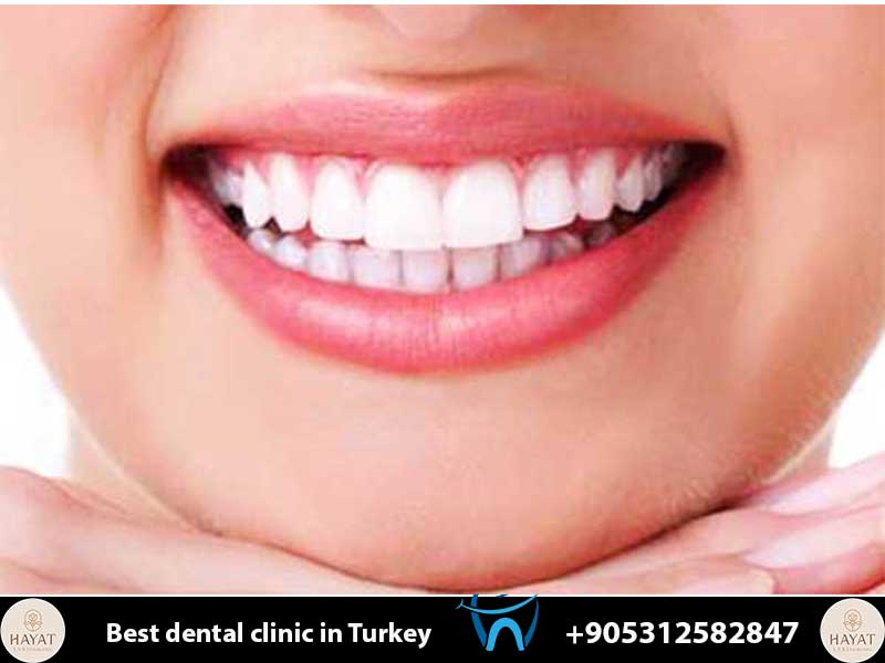 smile makeover packages