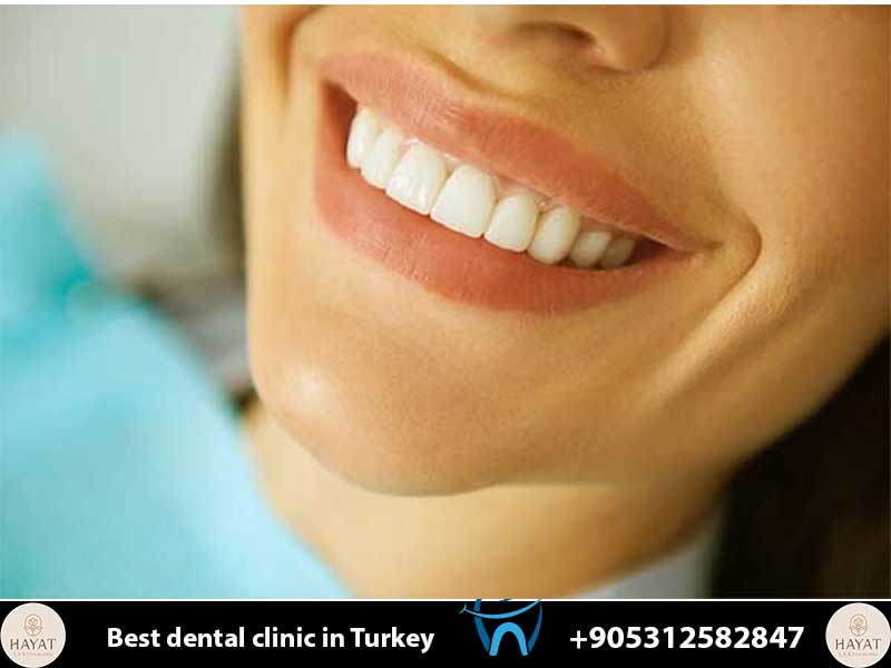 step by step guide to your dental trip itinerary