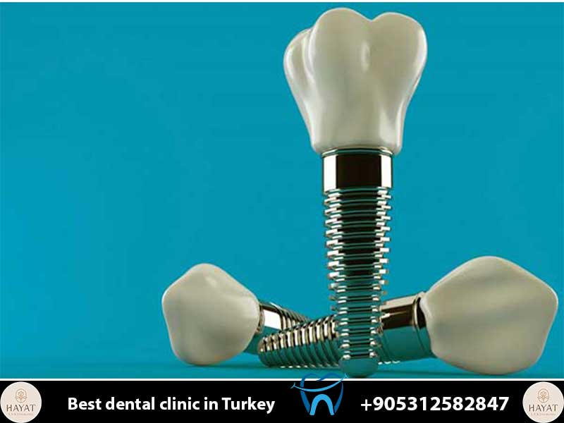 straumann implants turkey