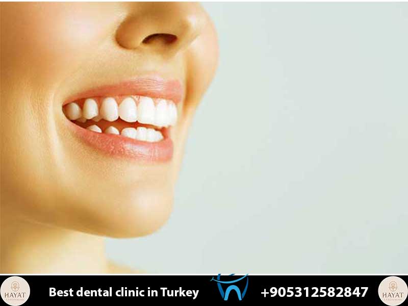 VIP Transport Accommodation: 5 Premium Comforts of Dental Tourism in Turkey vip transport accommodation