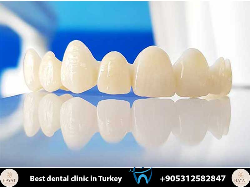 7 Hidden Costs of Dental Tourism to Avoid: Your 2026 Transparency Guide hidden costs of dental tourism to avoid